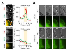 Beta-pix 결손에 따른 dynamin2 localization 변화