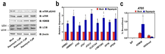 Rapamycin 처리 시 자가포식 관련 유전자의 발현조절에 KDM3B의 역할 규명