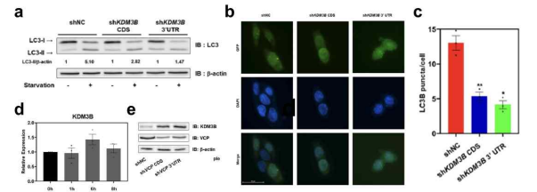 KDM3B가 자가포식에 미치는 영향 및 자가포식 시 KDM3B 단백질 발현 증가 원인 검토