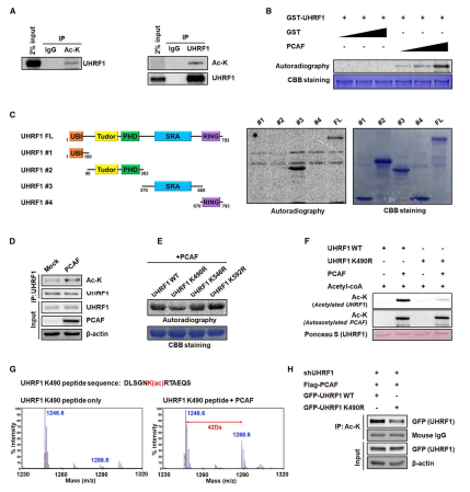 PCAF에 의한 UHRF1의 아세틸화 검증