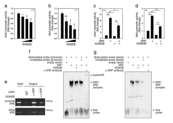 KDM2B의 SRF 억제 검증