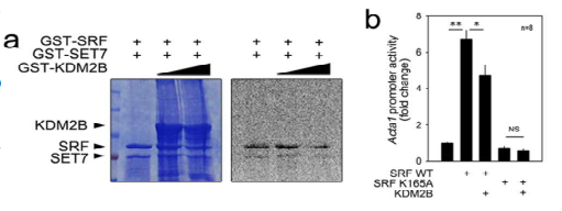 KDM2B에 의한 SRF의 탈메틸화