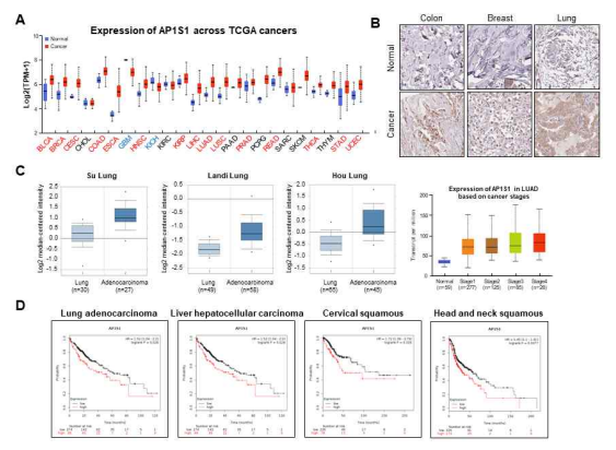 Public data를 활용한 다양한 암에서의 AP1S1 발현확인