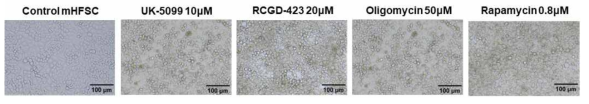 4가지 약물의 처리 농도에 따른 cell morphology 관찰 이미지