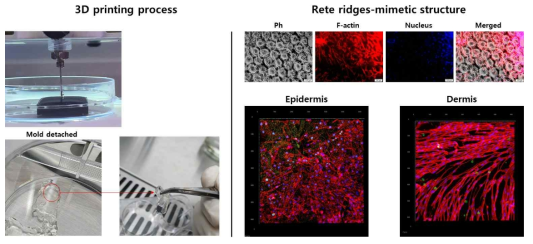 마이크로몰드를 사용한 진피-표피 기저막 재현. (좌) 3D 프린팅 과정 및 몰드 제거 후 진피-모사 구조체. (우 상단) 형광현미경을 통한 망융선(기저층)-모사 구조체 bright field 이미지 및 면역형광염색을 통한 각질형성 세포 형태 관찰. (우 하단) 공초점 레이저 주사현미경을 통한 표피 및 진피 세포 각각의 3D 이미징(적색: F액틴, blue: 핵, green: ki-67)