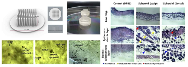 마이크로니들 사용 모낭 모유두 세포 스페로이드의 피부-모사 조직 구조체 주입. (좌 상단) 마이크로니들의 3D 모델링 및 마이크로니들 이미지. (좌 하단) 주입한 스페로이드 및 조직 모사체의 광학현미경 이미지. (우) 장기간 배양한 피부-모사 구조체의 면역형광염색 분석
