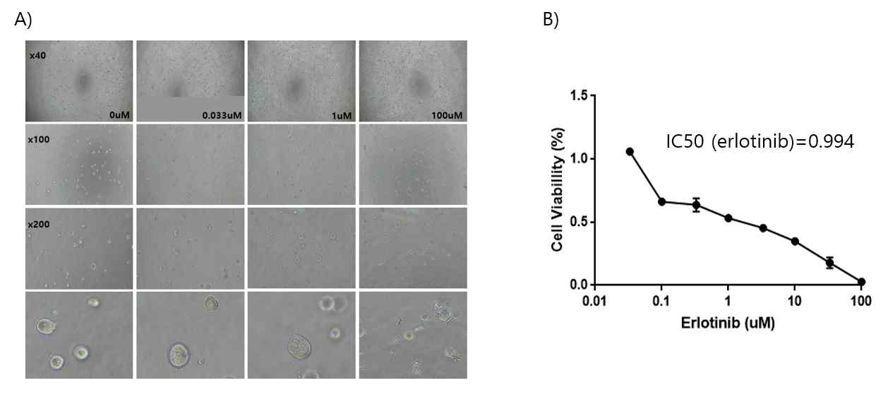 SMC 1 오가노이드에 대한 MTT. A) erlotinib으로 72시간 처리한 후 오가노이드 사진 B) erlotinib에 대한 IC50