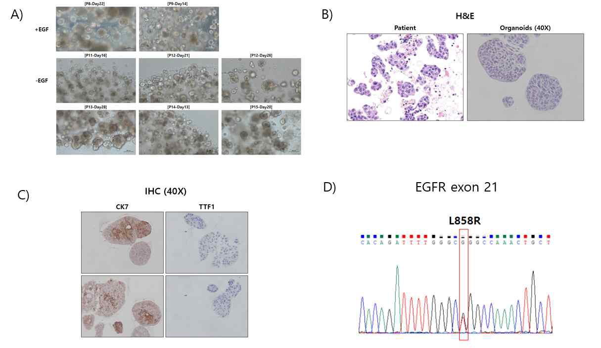 SMC1(선암 환자의 전이된 림프절에서 확보) 오가노이드 A) 오가노이드 사진 B) 환자 종양 조직과 오가노이드 H&E 염색 C) 오가노이드 면역 화학 염색 결과 D) 오가노이드에 대한 Sanger sequencing 결과
