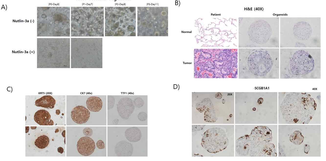 33. SMC4 오가노이드. A) 폐에서 확보한 정상 오가노이드 B) 폐 조직과 오가노이드 H&E 염색 C), D) 오가노이드 면역 화학 염색 결과(CK5, CK7, TTF-1, SCGB1A1)