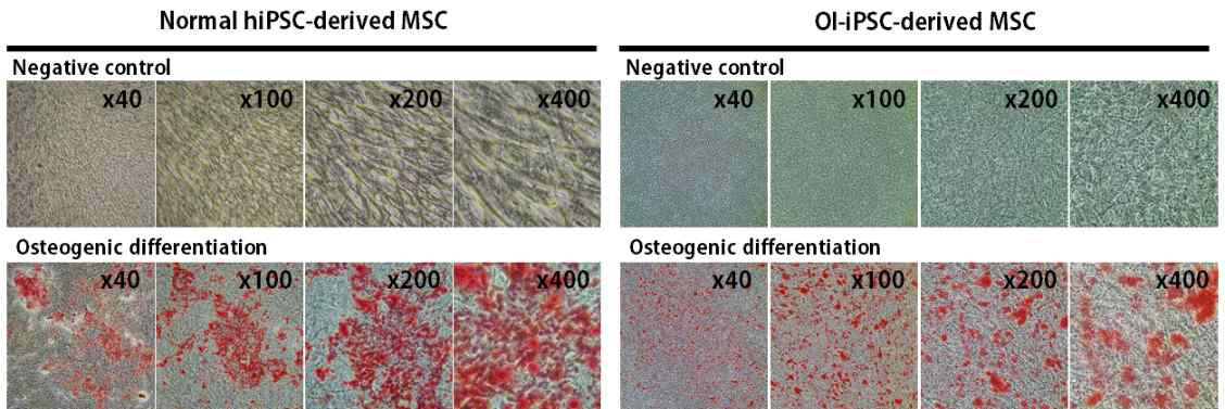환자유래 유도만능줄기세포유래 중간엽줄기세포의 골분화능 비교