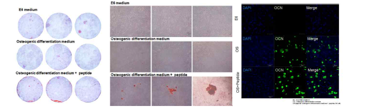 유도만능줄기세포의 골세포 분화 후 칼슘 염색 및 osteocalcin 발현 관찰
