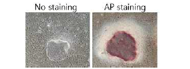 환자 혈액 유래 유도만능줄기세포(OI-iPSC#3)의 특성 분석
