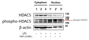 염증 조건 하에서 세포질 및 핵 내 HDAC 인산화 정도 관찰