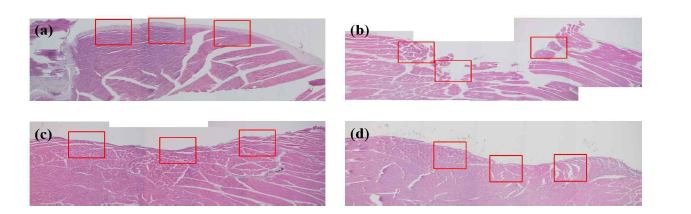 쥐 경골 근육 손실 동물 모델에서 6주 H&E 염색 결과: (a) 정상군, (b) 근육손실 only 군, (c) 다공성 마이크로스피어 삽입군 및 (d) 지방유래줄기세포 삽입군