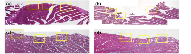 쥐 경골 근육 손실 동물 모델에서 6주 Masson’s trichrome 염색 결과: (a)정상군, (b) 근육 손실 only 군, (c) 다공성 마이크로스피어 삽입군 및 (d) 지방유래줄기세포 삽입군