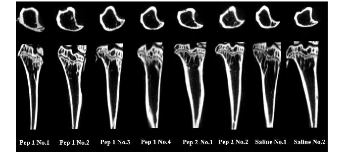 골형성부전증 동물모델 16주 골 형성 Micro-CT 단면 이미지
