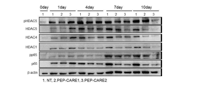 PEP-CARE1, PEP-CARE2의 HDAC 억제능 확인