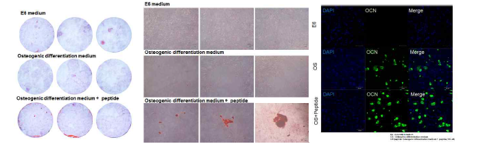 유도만능줄기세포의 골세포 분화 후 칼슘 염색 및 osteocalcin 발현 관찰