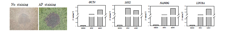 환자 혈액 유래 유도만능줄기세포(OI-iPSC#2)의 특성 분석