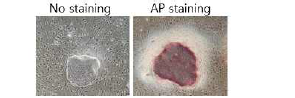 환자 혈액 유래 유도만능줄기세포(OI-iPSC#3)의 특성 분석