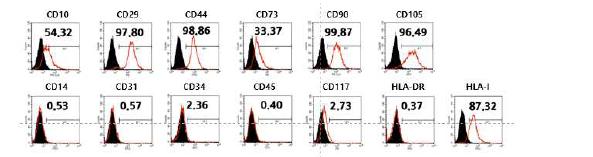 OI-iPSC#2 유래 중간엽줄기세포의 특성 분석