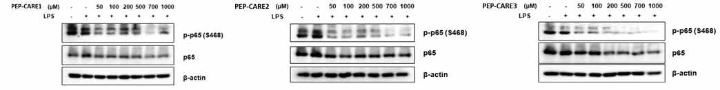 NF-κB p65 phosphorylation 확인을 위한 western blot 결과
