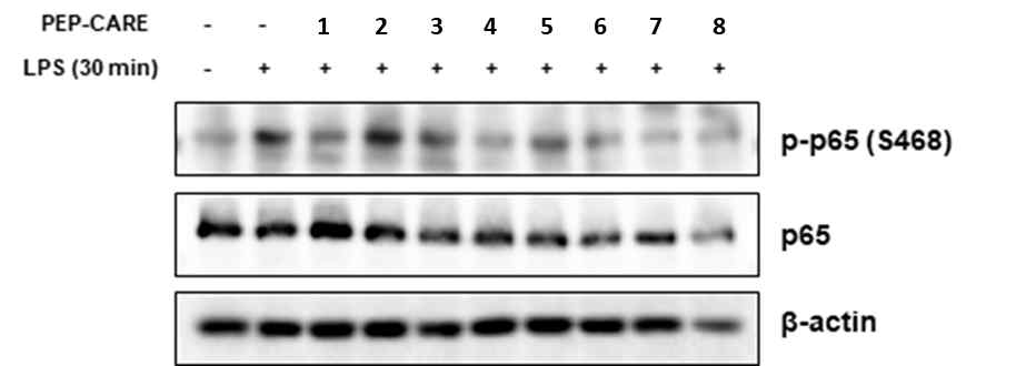 PEP-CARE 및 그 유도체 처리 후 p65(NF-κB) western blot 결과
