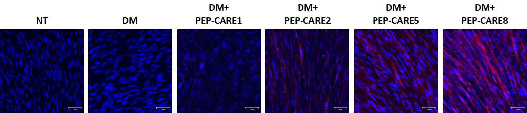 myogenin 단백질에 대한 immunofluorescence 염색 결과 (NT :　not treatment, DM : differentiation medium, 파란색 : 핵, 빨간색 : myogenin)