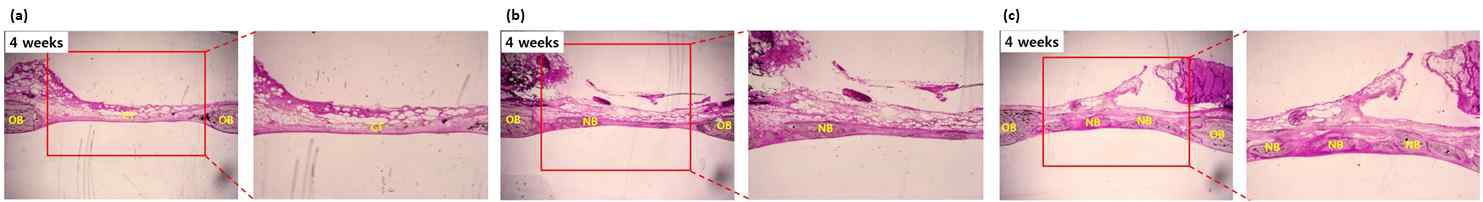 동물 수준에서 스마트 바이오소재 골재생능 평가. 아무것도 이식하지 않은 실험군(a), 시판중인 이식재(b), 그리고 제작한 스마트 바이오소재(c)를 defect에 이식 후 4주 뒤 defect 부위의 골재생 정도를 H&E stain을 통하여 확인함.(OB: old bone, NB: new bone, CT: connective tissue)