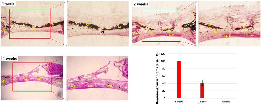 스마트바이오소재 이식 후 체내 생분해성 확인(OB: old bone, NB: new bone, CT: connective tissue, M: matrix 스마트바이오소재)