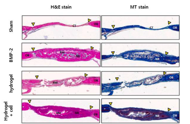 TMSC 탑재 콜라겐 수화젤 이식 동물모델의 조직 절편의 H&E 염색 및 MT 염색사진