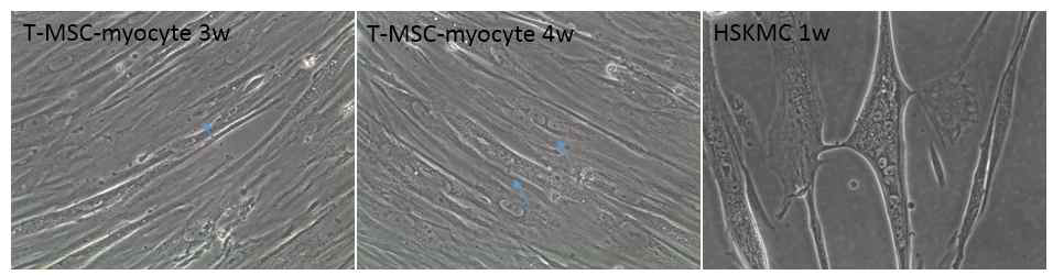 분화기간 연장에 따른 T-MSC-myocyte의 세포융합비율의 증가