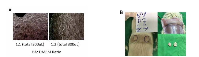1×106의 TMSC를 HA:DMEM의 비율을 1:1 (total 200uL) 그리고 1:2 (total 300 uL)로 혼합하 여 (A) 세포와 HA의 혼합력을 현미경으로 관찰한 결과. (B) 섞은 혼합물을 쥐의 피하에 주사한 뒤, 다음날 쥐의 피하에 주사된 혼합물을 빼내어 형태와 보존도를 관찰한 결과.