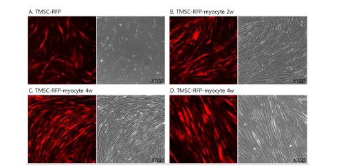 이식용 TMSC-myocyte의 RFP 발현 확인. A. RFP가 tagging된 TMSC (TMSC-RFP) B. TMSC-RFP로부터 근육세포로 2주 분화 (TMSC-RFP-myocyte 2w) C-D. TMSC-RFPmyocyte 4w