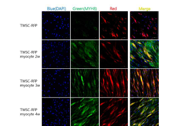 이식용 TMSC-RFP-myocyte의 근육세포로의 분화 확인: Blue (DAPI); Green (myosin heavy chain 8, MYH8); Red (RFP) x200.