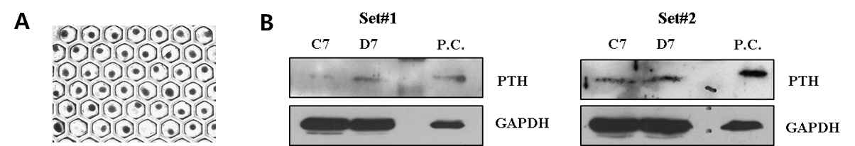Donor#1의 TMSC를 1.2x10^6/concave plate (384wells)에 심어서 7일동안 분화 시켜, 3D spheroid를 제작한 결과. A. 7일간 미분화/분화 배지에 배양한 세포들의 형태. B. Western blotting을 사용한 PTH의 단백질 정량결과.