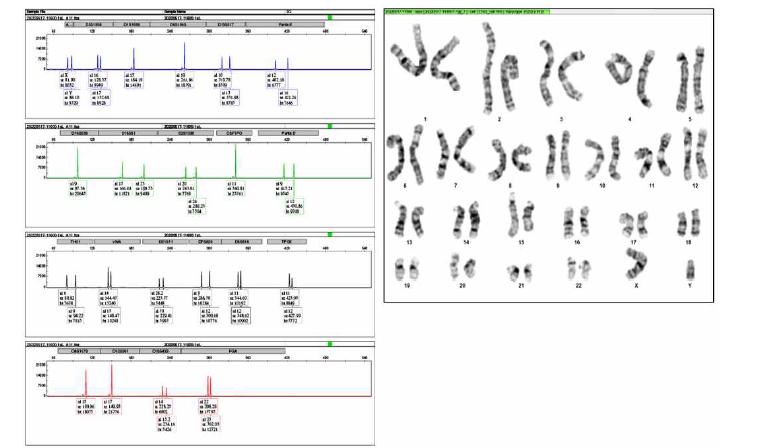 세포은행(DS)의 STR 및 핵형분석 결과