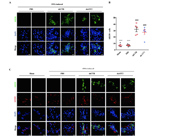 ATF2 KD UC-MSC in vivo 생착률 평가