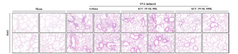 Histology 정량 평가