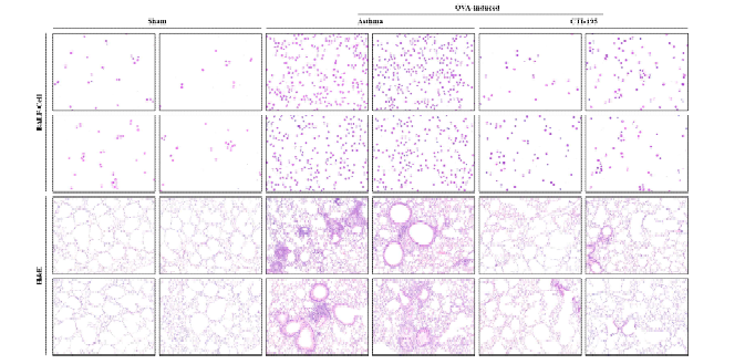 Asthma stem cell 효능평가 & Histology 정량 평가