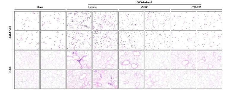 Asthma stem cell 효능평가 & Histology 정량 평가