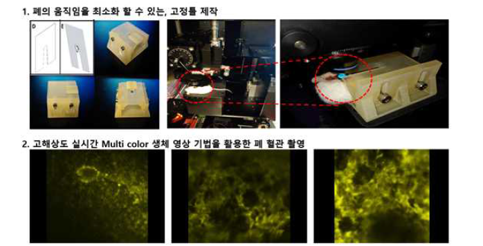 천식모델 mouse 폐에서 고해상도 생체 혈관 촬영