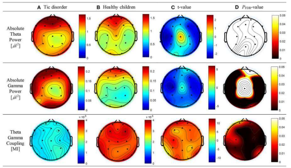 틱 장애 소아 환자과 정상 대조군 어린이에서 Absolute theta power (top panel)와 gamma power (middle panel), theta-gamma coupling (bottom panel)의 Topography (A,B) 와 군 간 independent t-test 통계 결과 (C,D)