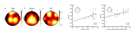 Working Memory Task 수 행 시 Theta, Gamma, TGC의 Topography. TGC는 Theta Power 또는 Gamma Power와는 다른 양상 으로 인지 기능 정도를 반영(본 연구 팀의 선행연구 결과)
