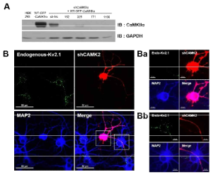CaMKIIα knock-out에 의한 Kv2.1의 조절