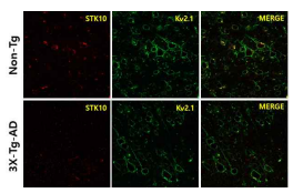 전두엽에서 Non-Tg와 3X-Tg-AD 쥐에 서 STK10의 발현 변화