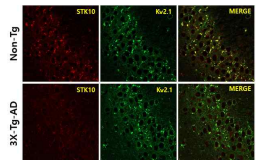 해마조직에서 Non-Tg와 3X-Tg-AD 쥐 에서 STK10의 발현