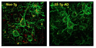 3X-Tg-AD모델에서 신경세포내의 STK10과 Kv2.1 발현