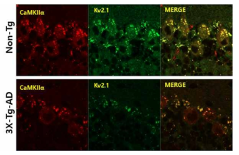 소뇌에서 질병에 다른 CaMKIIα과 Kv2.1의 발현 패턴
