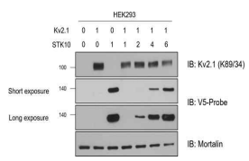 STK10에 의한 Kv2.1의 발현 변화